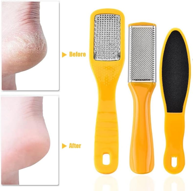 KANGDD 10 ב 1 כלי פדיקור מקצועי לוח שפשוף כף רגל סט רגליים טחינת עור מת פדיקור כלי פילינג לטיפול בעור